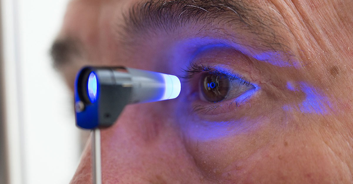 Glaucoma